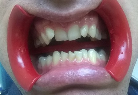 ортодонт в Николаеве