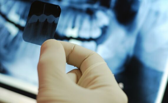 рентген зубов в Николаеве