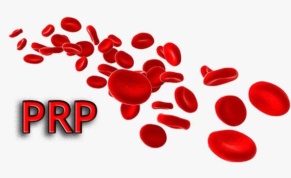 плазмотерапия, Николаев