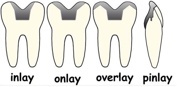 Виды вкладок